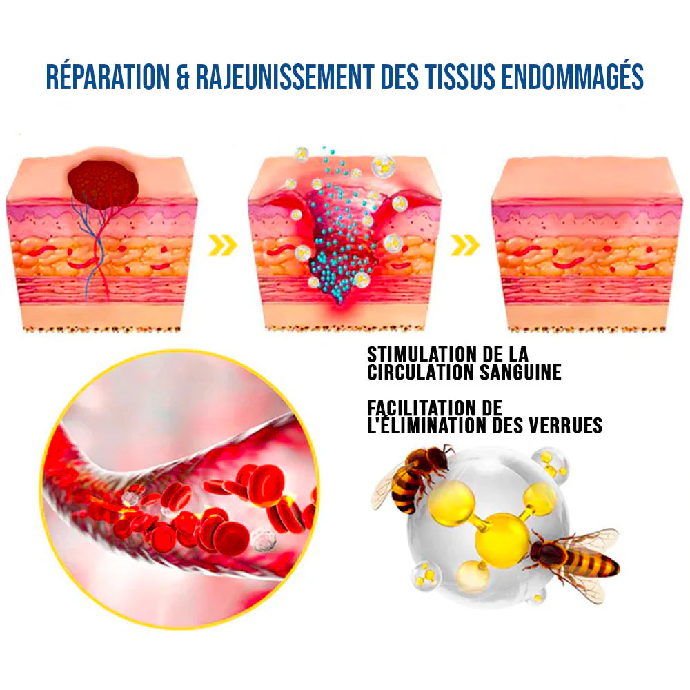 Spray Traitement au Venin d'Abeille